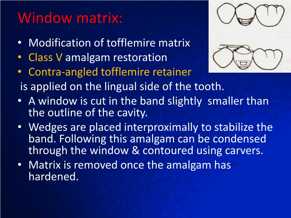 window matrix