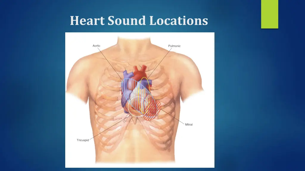 heart sound locations