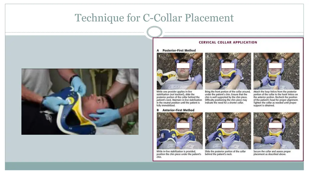 technique for c collar placement