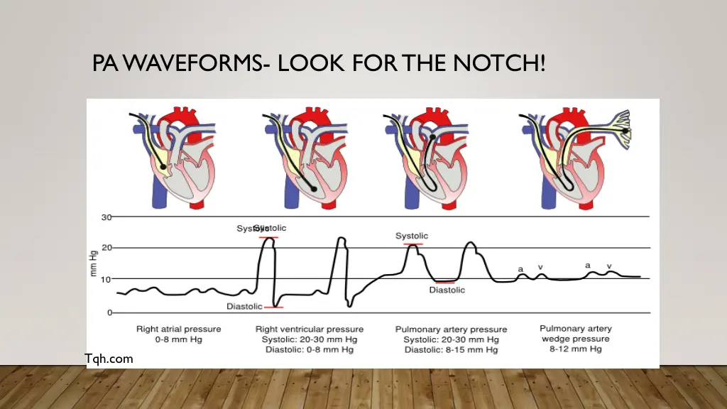 pa waveforms look for the notch