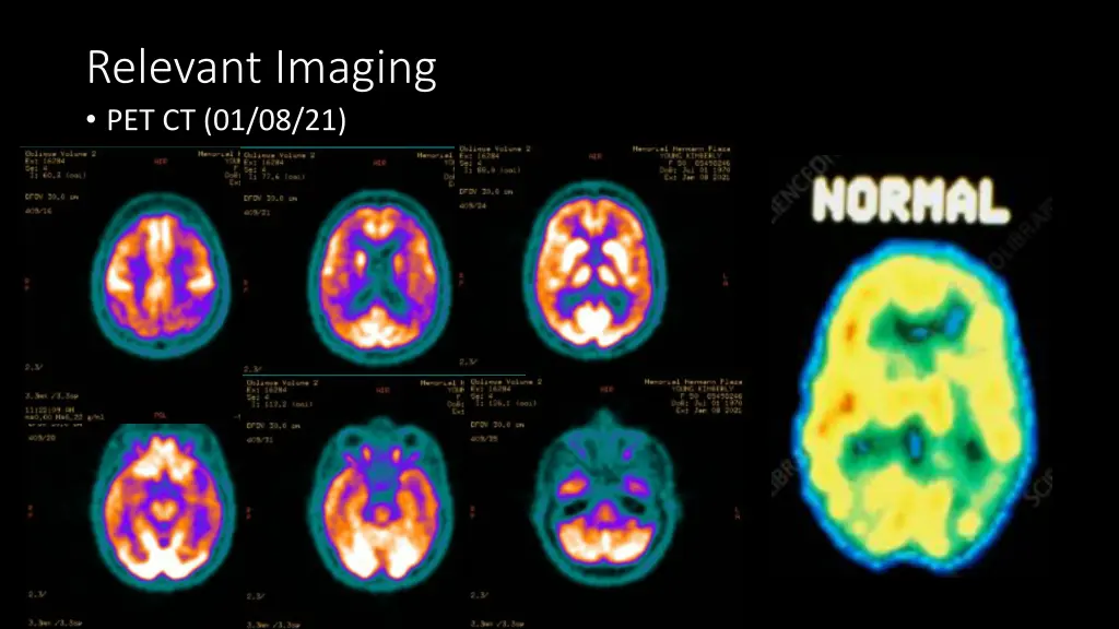 relevant imaging pet ct 01 08 21 1