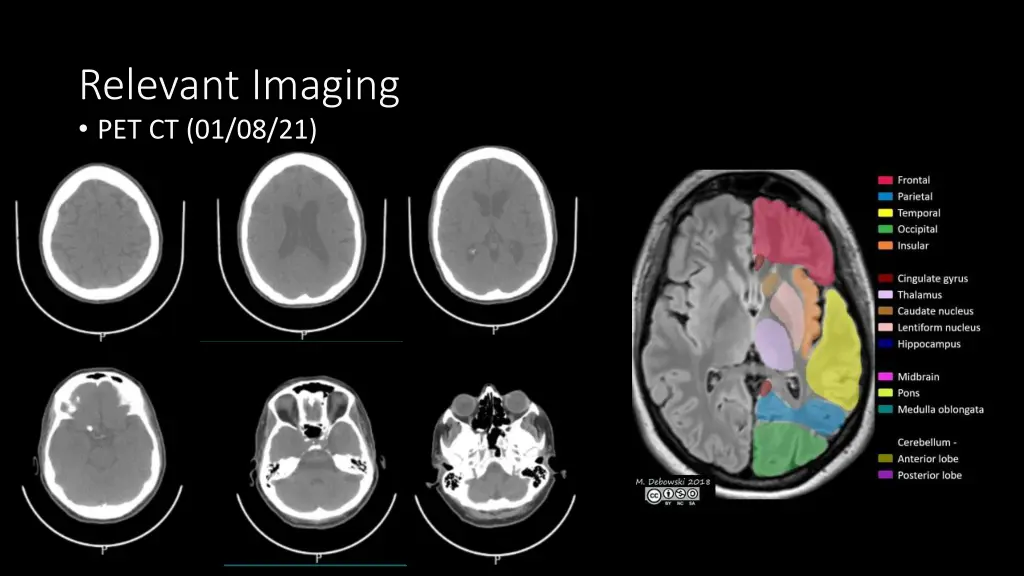 relevant imaging pet ct 01 08 21