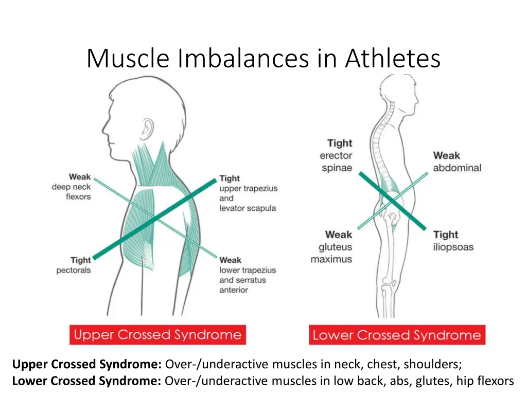 muscle imbalances in athletes