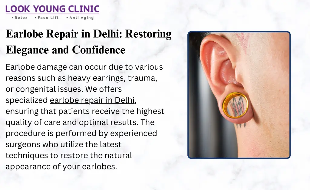 earlobe repair in delhi restoring elegance