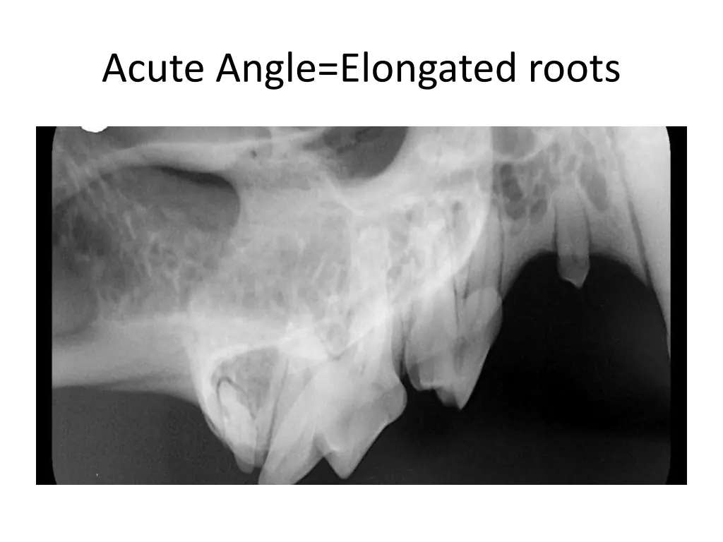 acute angle elongated roots