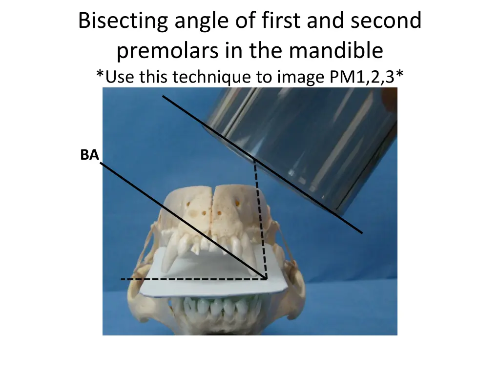 bisecting angle of first and second premolars