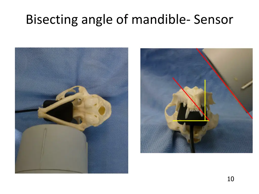 bisecting angle of mandible sensor