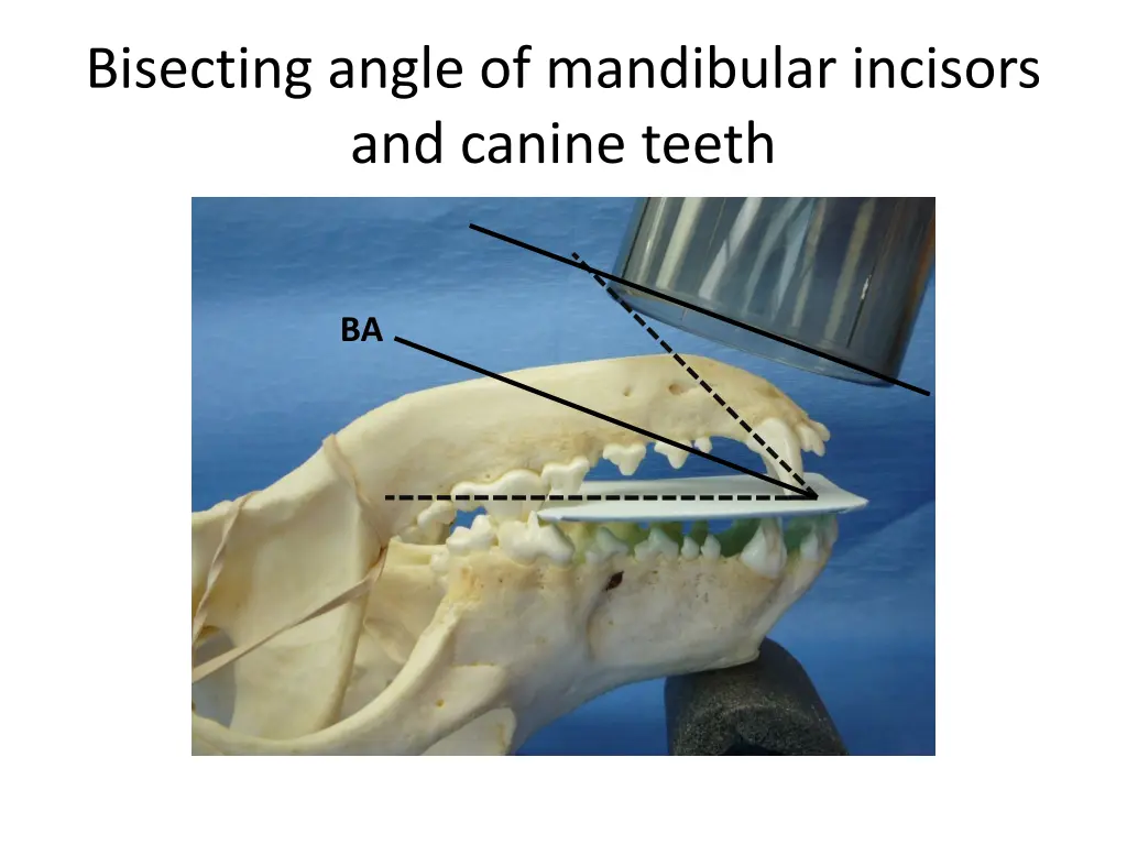 bisecting angle of mandibular incisors and canine