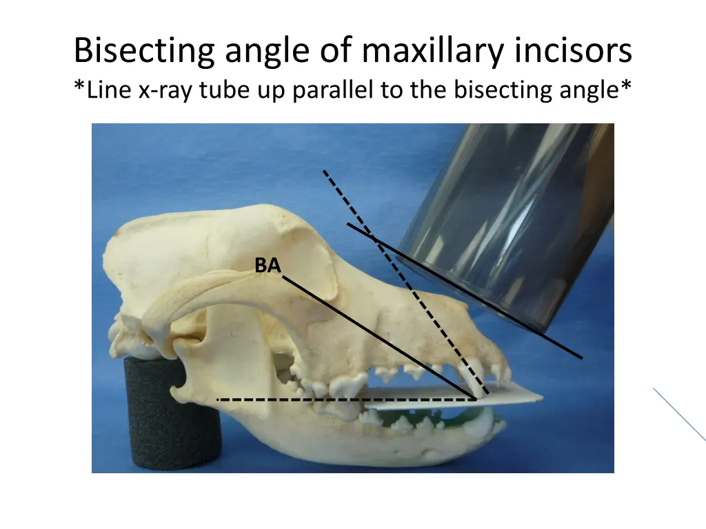 bisecting angle of maxillary incisors line