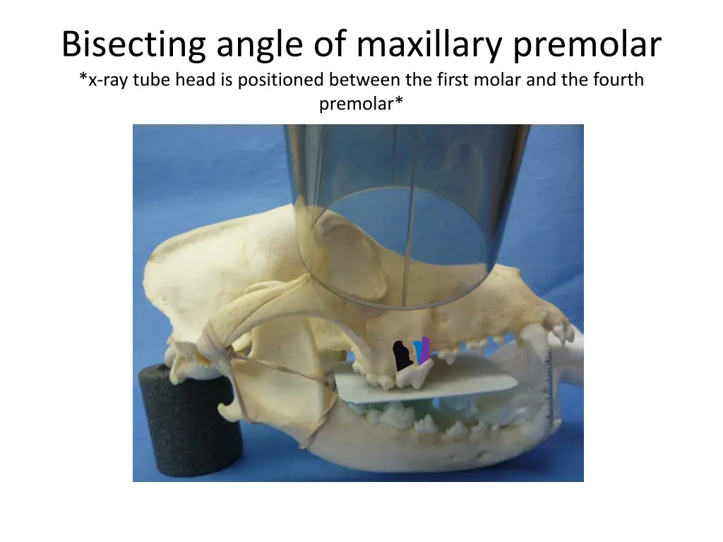 bisecting angle of maxillary premolar x ray tube