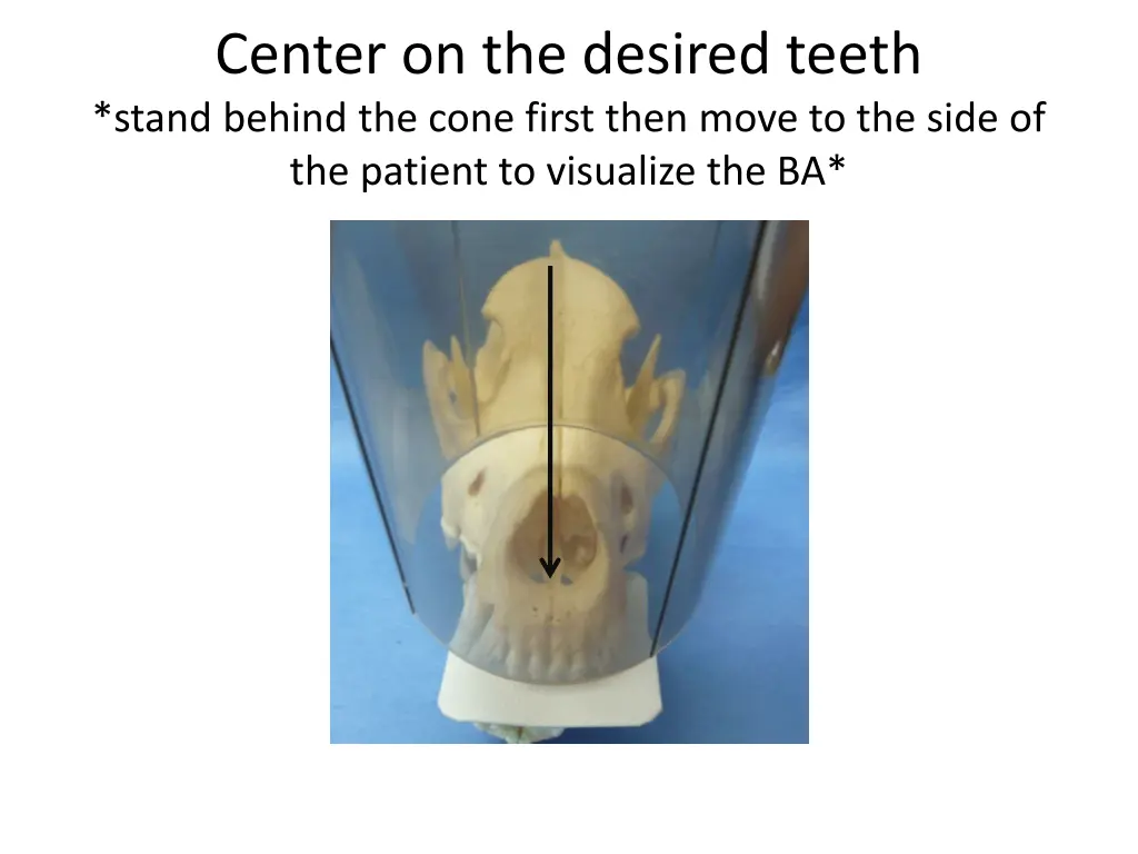 center on the desired teeth stand behind the cone