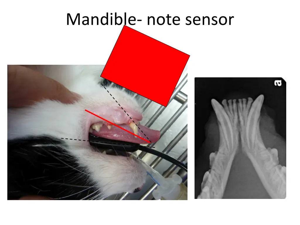 mandible note sensor