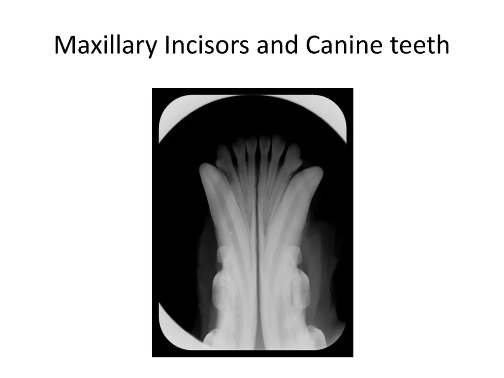 maxillary incisors and canine teeth