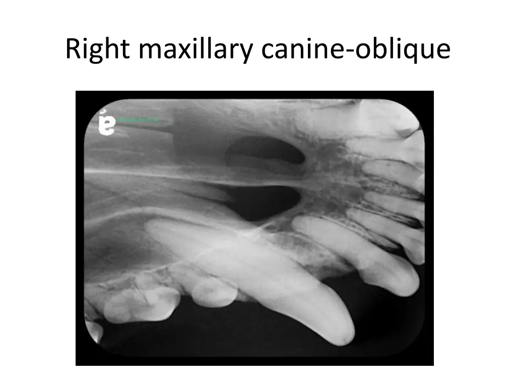 right maxillary canine oblique