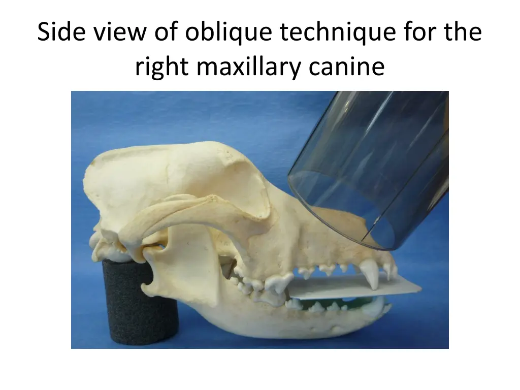 side view of oblique technique for the right