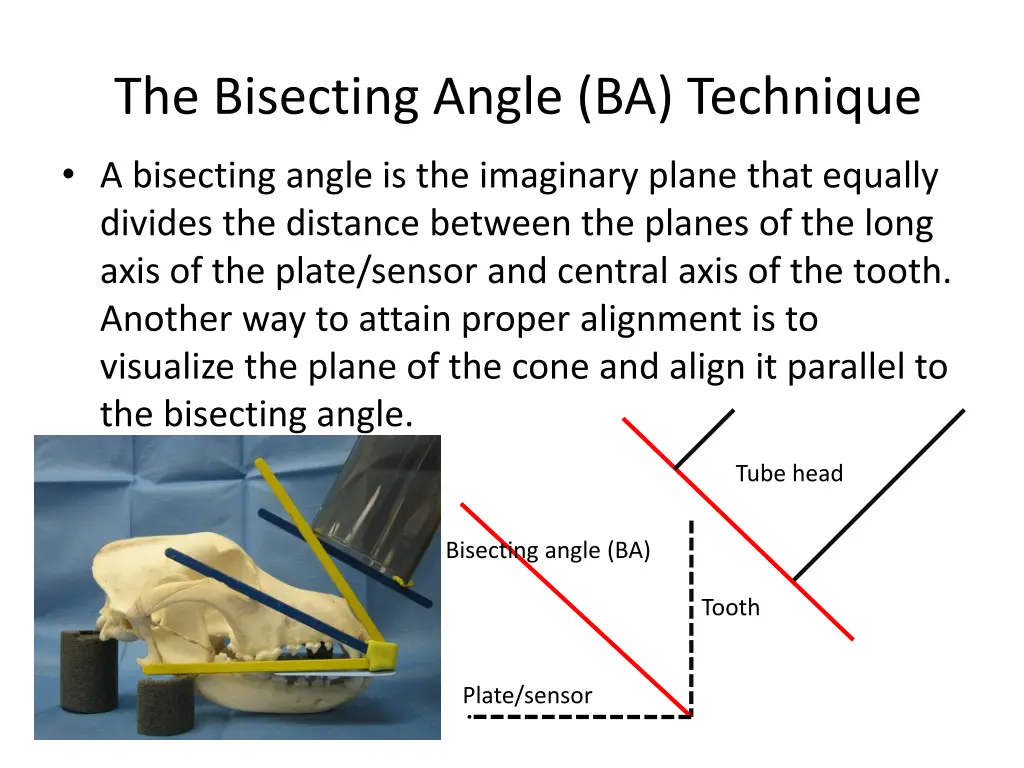 the bisecting angle ba technique