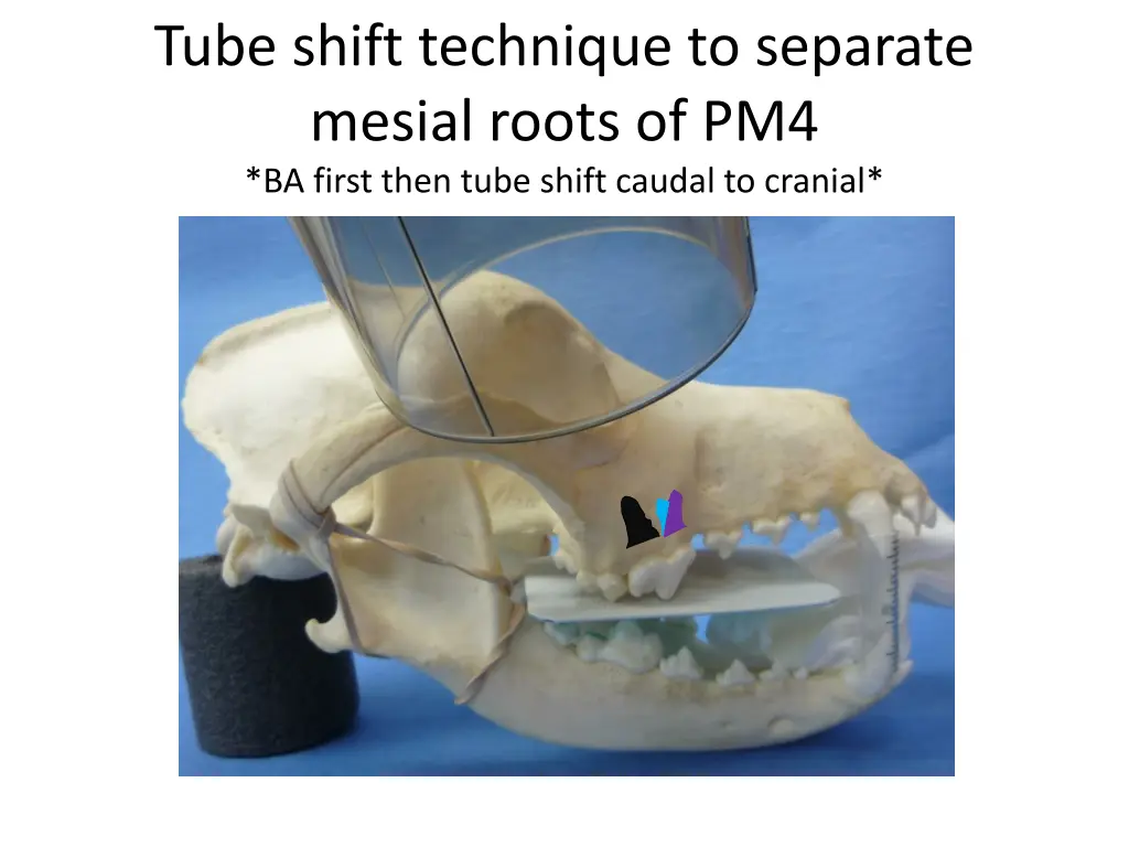 tube shift technique to separate mesial roots 1