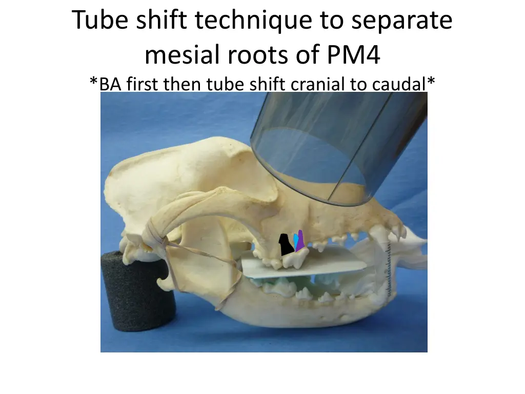 tube shift technique to separate mesial roots