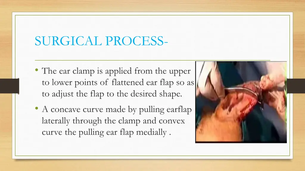 surgical process