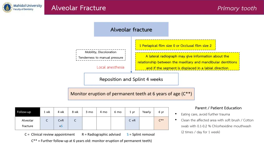 alveolar fracture