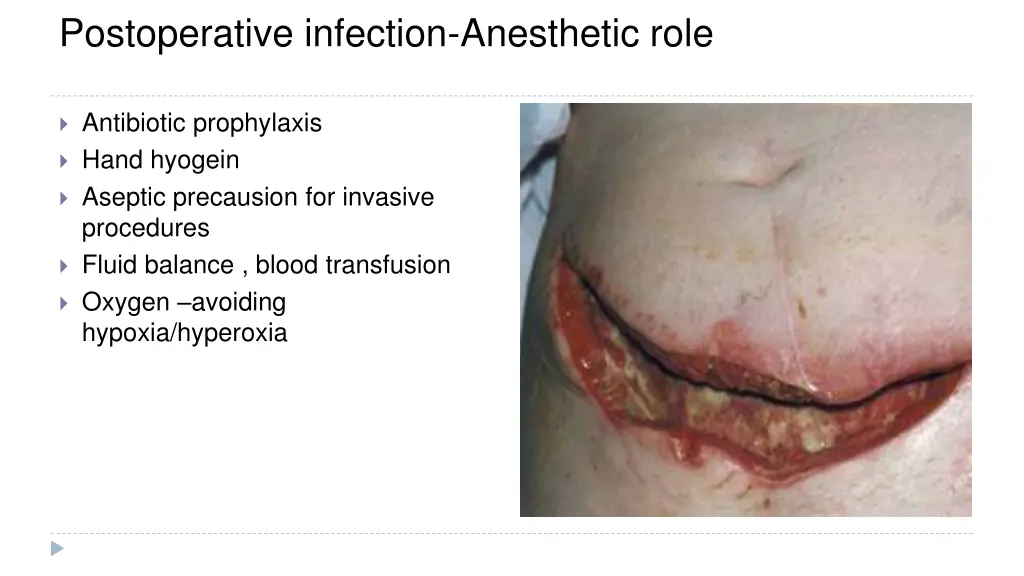 postoperative infection anesthetic role ole