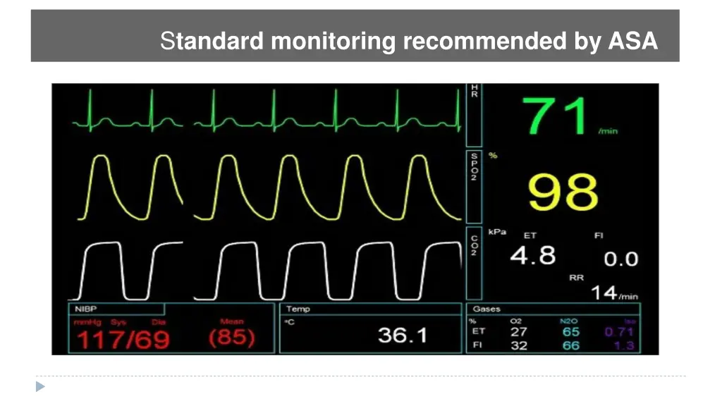 s tandard monitoring recommended by asa