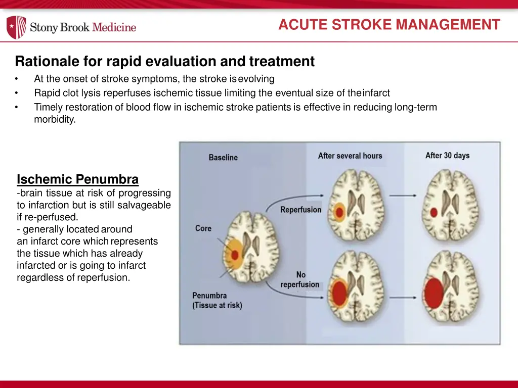 acute stroke management 1