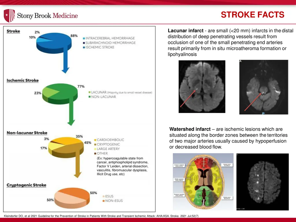 stroke facts 1