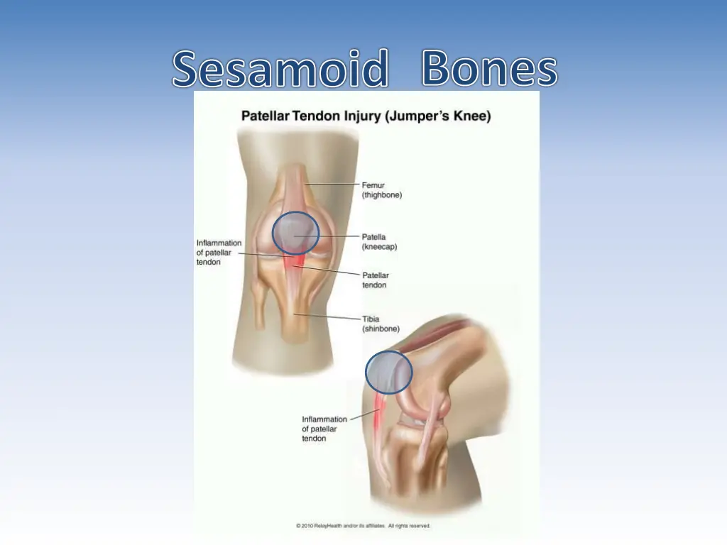 sesamoid bones