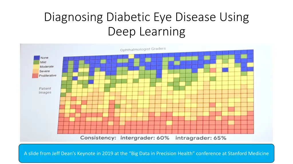 diagnosing diabetic eye disease using deep 4