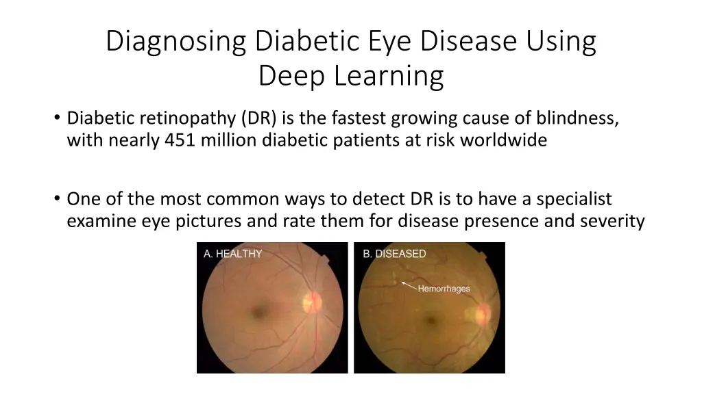 diagnosing diabetic eye disease using deep