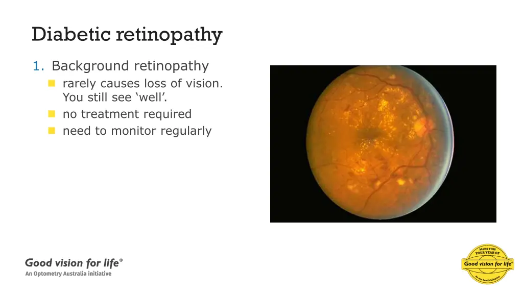 diabetic retinopathy