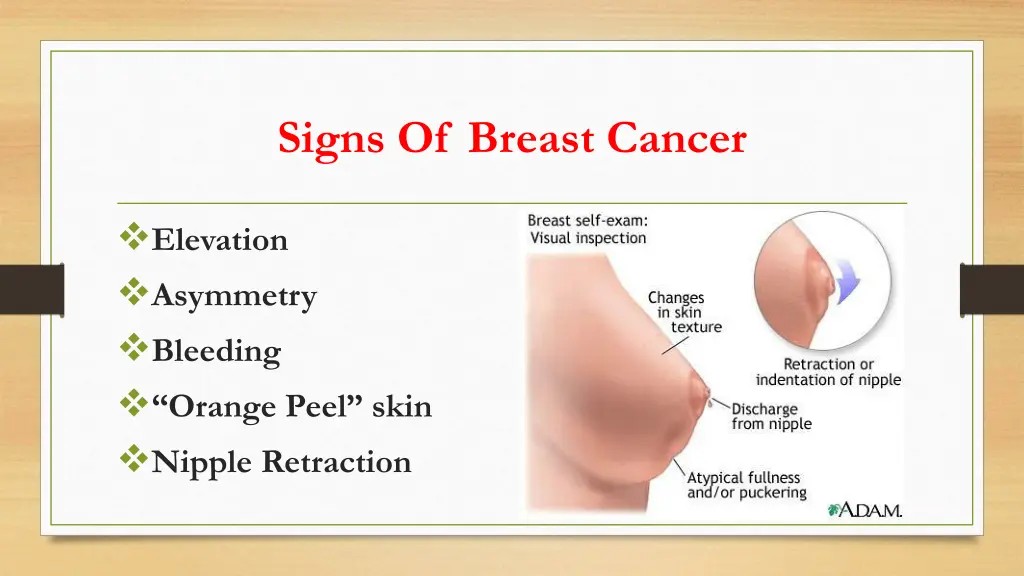 signs of breast cancer