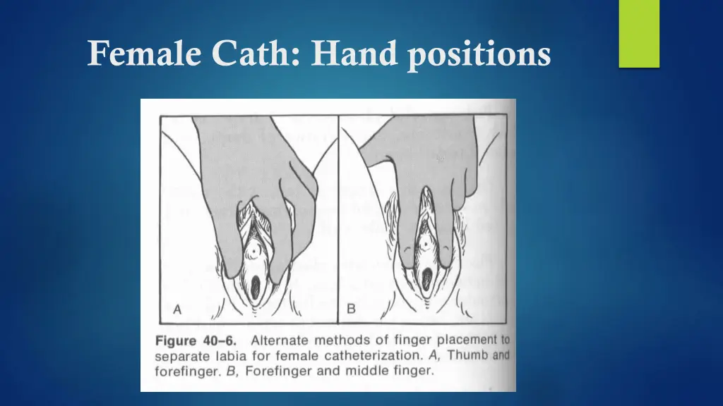 female cath hand positions