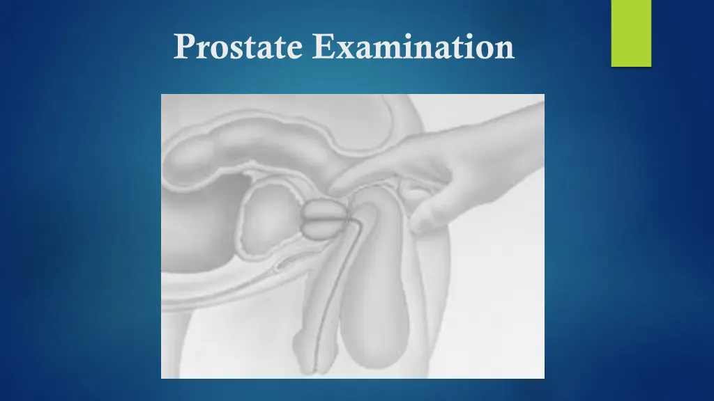 prostate examination