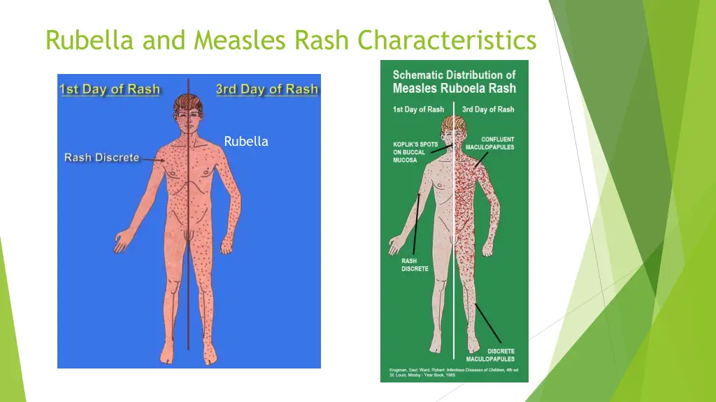 rubella and measles rash characteristics