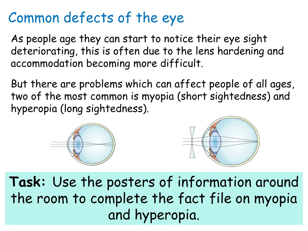 common defects of the eye as people age they