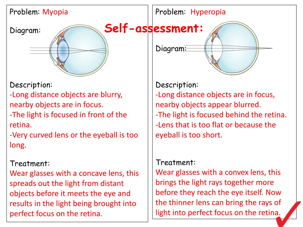 problem myopia