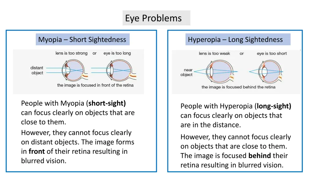 eye problems