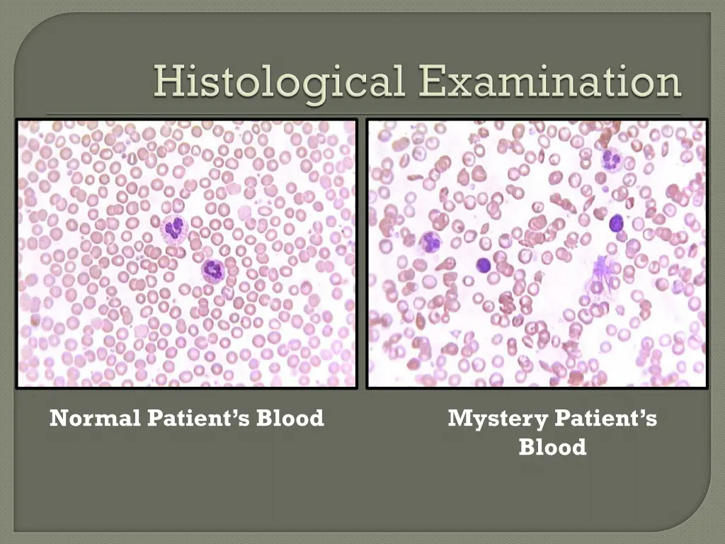 normal patient s blood