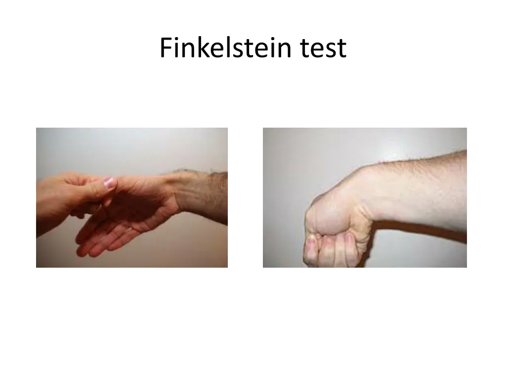 finkelstein test