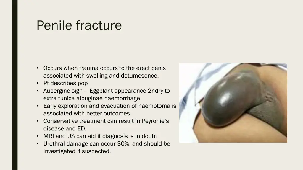 penile fracture