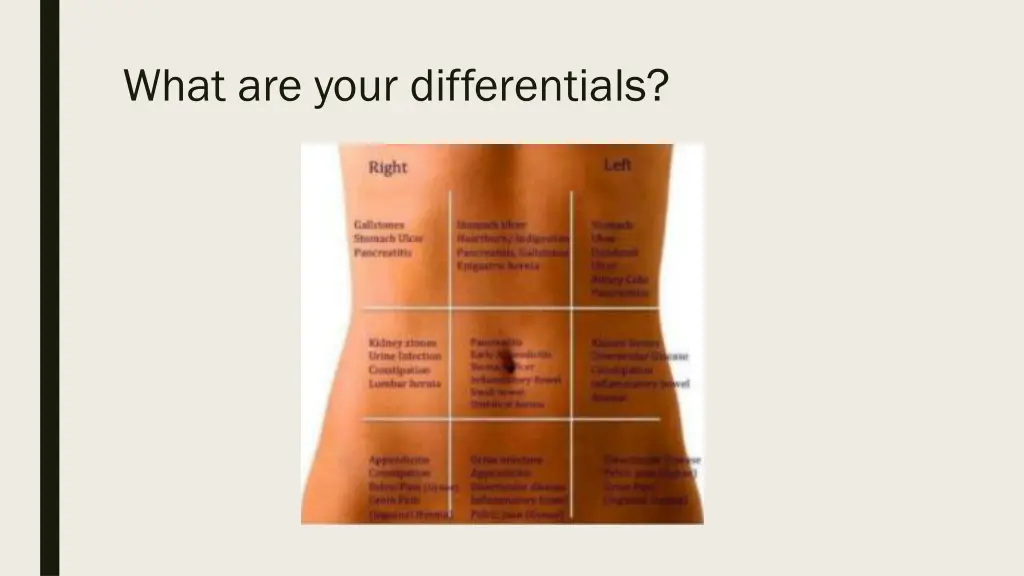 what are your differentials