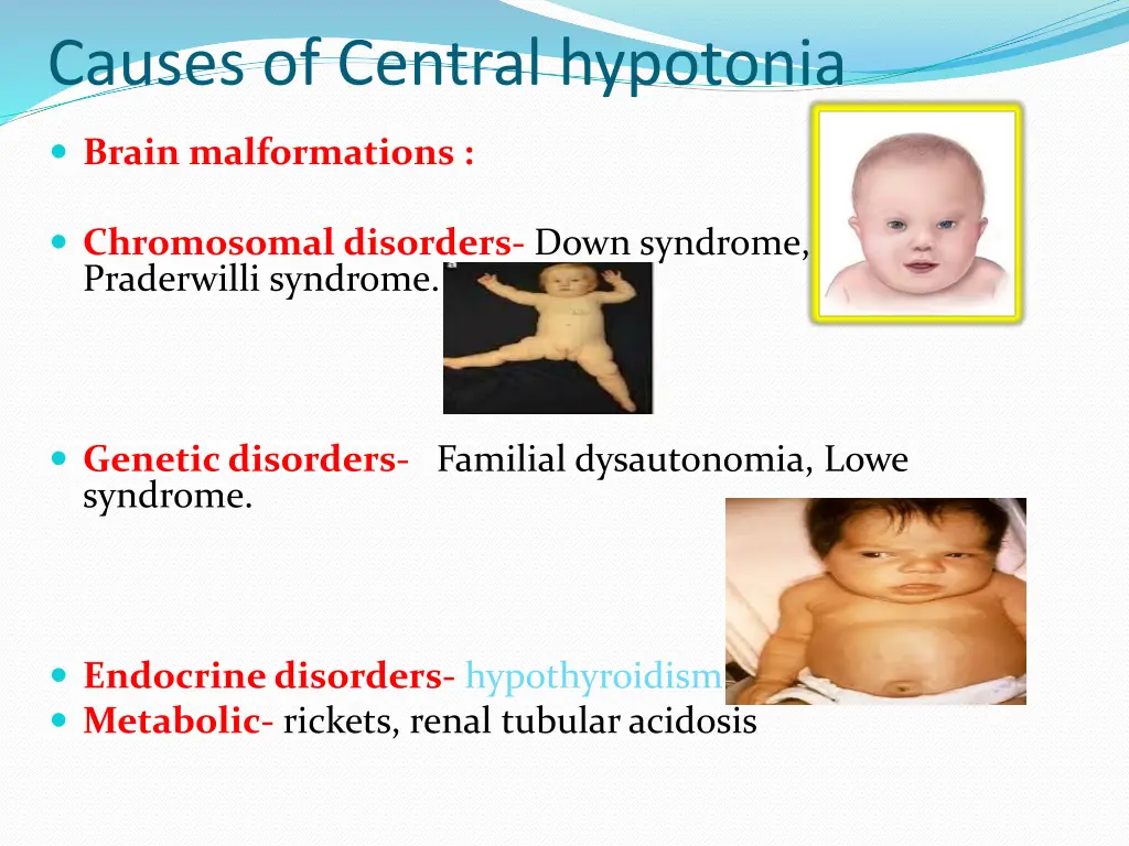 causes of central hypotonia