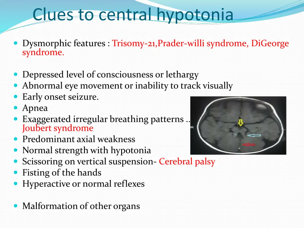 clues to central hypotonia