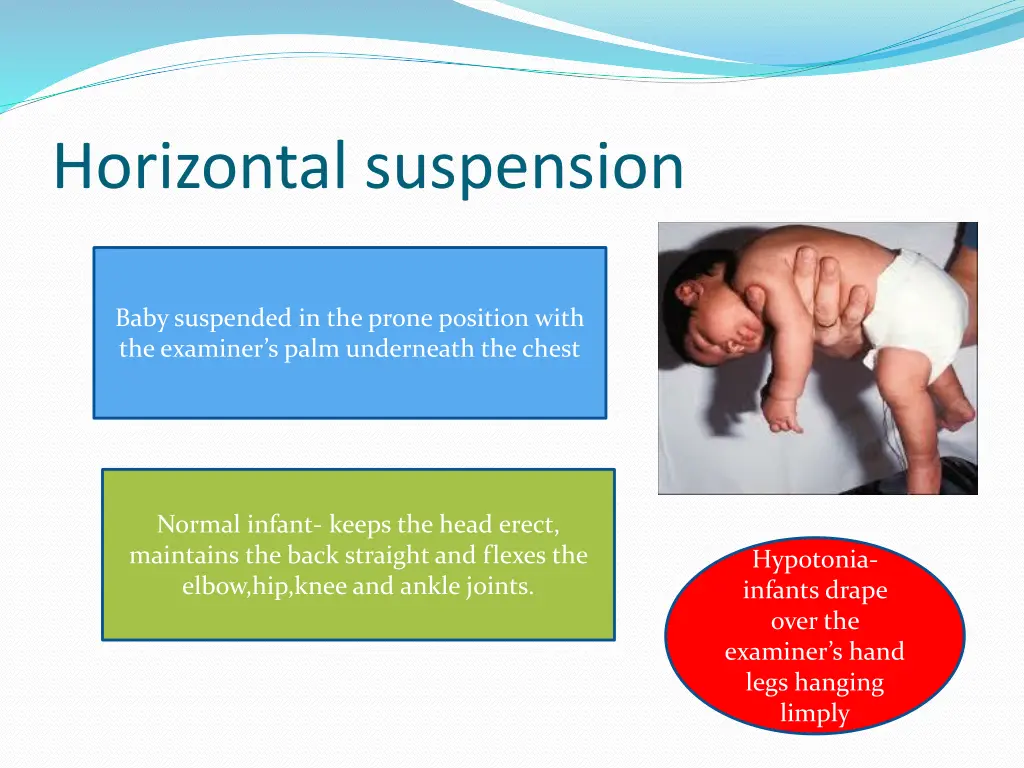 horizontal suspension