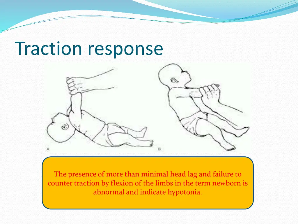 traction response