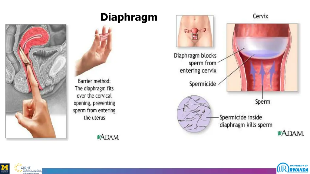 diaphragm