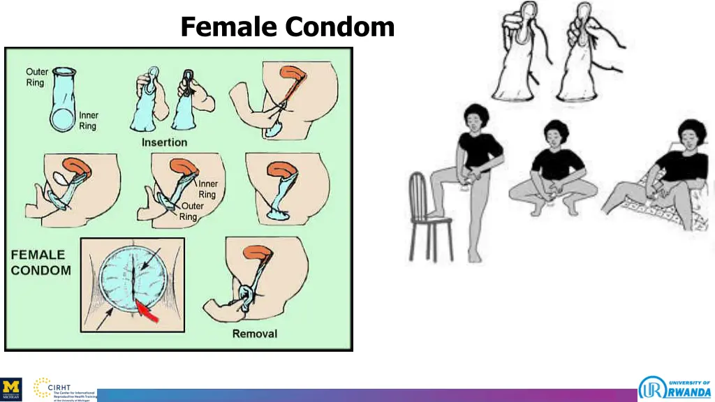 female condom 1