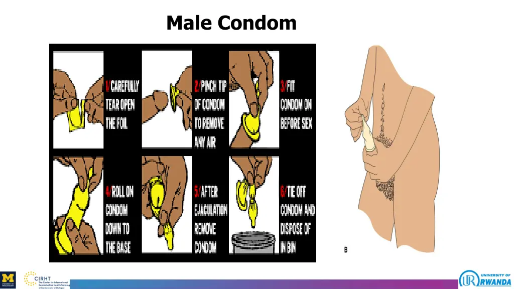 male condom 2